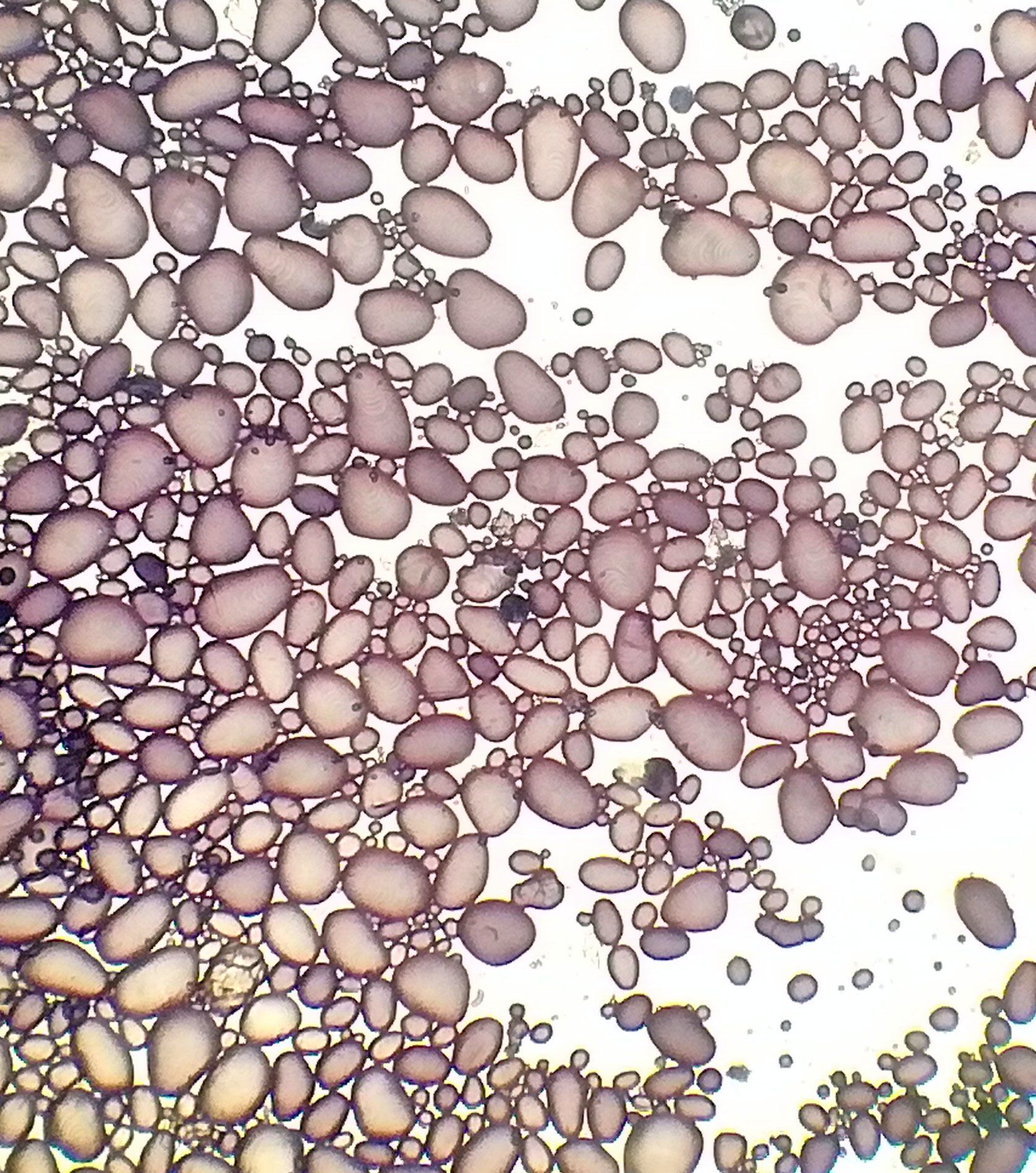 Frottis d'amyloplaste de cellules de pommes de terre colorés à l'eau iodée et observés au microscope optique x 100